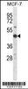 Western blot analysis in MCF-7 cell line lysates (35ug/lane) .