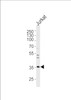 Western blot analysis of lysate from Jurkat cell line, using GLRB Antibody at 1:1000 at each lane.