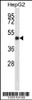 Western blot analysis in HepG2 cell line lysates (35ug/lane) .