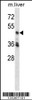 Western blot analysis in mouse liver tissue lysates (35ug/lane) .