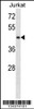 Western blot analysis in Jurkat cell line lysates (35ug/lane) .