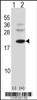 Western blot analysis of BARX1 using rabbit polyclonal BARX1 Antibody using 293 cell lysates (2 ug/lane) either nontransfected (Lane 1) or transiently transfected (Lane 2) with the BARX1 gene.