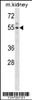 Western blot analysis in mouse kidney tissue lysates (35ug/lane) .