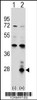 Western blot analysis of AZU1 using rabbit polyclonal AZU1 Antibody using 293 cell lysates (2 ug/lane) either nontransfected (Lane 1) or transiently transfected (Lane 2) with the AZU1 gene.