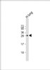 Western Blot at 1:2000 dilution + human lung lysate Lysates/proteins at 20 ug per lane.