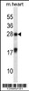 Western blot analysis in mouse heart tissue lysates (35ug/lane) .