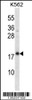 Western blot analysis in K562 cell line lysates (35ug/lane) .