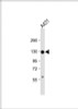 Western Blot at 1:1000 dilution + A431 whole cell lysate Lysates/proteins at 20 ug per lane.