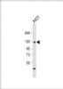 Western Blot at 1:1000 dilution + A431 whole cell lysate Lysates/proteins at 20 ug per lane.