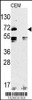 Western Blot in CEM cell line lysate. TLR2-V735 (arrow) was detected using the purified Pab.