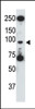 Antibody is used in Western blot to detect TLR5 in HL60 cell lysate.