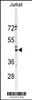 Western blot analysis of GJA3 Antibody in Jurkat cell line lysates (35ug/lane)