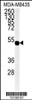 Western blot analysis of hGJA7-H104.Connexin in MDA-MB435 cell line lysates (35ug/lane)