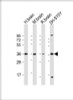 Western Blot at 1:2000 dilution Lane 1: human brain lysate Lane 2: mouse brain lysate Lane 3: rat brain lysate Lane 4: SH-SY5Y whole cell lysate Lysates/proteins at 20 ug per lane.