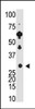 Antibody is used in Western blot to detect Recoverin in Y79 cell lysate.