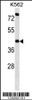 Western blot analysis in K562 cell line lysates (35ug/lane) .