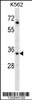 Western blot analysis in K562 cell line lysates (35ug/lane) .