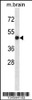 Western blot analysis in mouse brain tissue lysates (35ug/lane) .