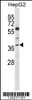 Western blot analysis in HepG2 cell line lysates (35ug/lane) .