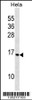 Western blot analysis in Hela cell line lysates (35ug/lane) .