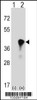 Western blot analysis of C4BPB using rabbit polyclonal C4BPB Antibody using 293 cell lysates (2 ug/lane) either nontransfected (Lane 1) or transiently transfected (Lane 2) with the C4BPB gene.