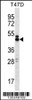 Western blot analysis in T47D cell line lysates (35ug/lane) .