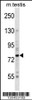 Western blot analysis in mouse testis tissue lysates (35ug/lane) .