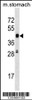 Western blot analysis in mouse stomach tissue lysates (35ug/lane) .