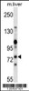 Western blot analysis in mouse liver tissue lysates (35ug/lane) .