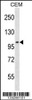 Western blot analysis in CEM cell line lysates (35ug/lane) .