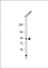 Western Blot at 1:1000 dilution + human brain lysate Lysates/proteins at 20 ug per lane.