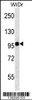 Western blot analysis in WiDr cell line lysates (35ug/lane) .