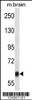 Western blot analysis in mouse brain tissue lysates (35ug/lane) .