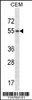 Western blot analysis in CEM cell line lysates (35ug/lane) .This demonstratedetected the Hck protein (arrow) .