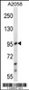 Western blot analysis in A2058 cell line lysates (35ug/lane) .