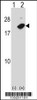 Western blot analysis of NUDT2 using rabbit polyclonal NUDT2 Antibody using 293 cell lysates (2 ug/lane) either nontransfected (Lane 1) or transiently transfected (Lane 2) with the NUDT2 gene.