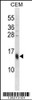 Western blot analysis in CEM cell line lysates (35ug/lane) .