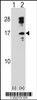 Western blot analysis of CLC using rabbit polyclonal CLC Antibody using 293 cell lysates (2 ug/lane) either nontransfected (Lane 1) or transiently transfected (Lane 2) with the CLC gene.