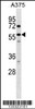 Western blot analysis in A375 cell line lysates (35ug/lane) .