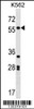 Western blot analysis in K562 cell line lysates (35ug/lane) .