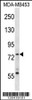 Western blot analysis in MDA-MB453 cell line lysates (35ug/lane) .This demonstratedetected the Syk protein (arrow) .