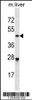 Western blot analysis in mouse liver tissue lysates (35ug/lane) .