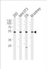 Western blot analysis of lysates from 293, mouse NIH/3T3, rat C6 cell line and mouse kidney tissue lysate (from left to right) , using Mouse Cdk9 Antibody at 1:1000 at each lane.