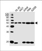 Western Blot at 1:1000 dilution Lane 1: HL-60 whole cell lysate Lane 2: A431 whole cell lysate Lane 3: Jurkat whole cell lysate Lane 4: Hela whole cell lysate Lane 5: A2058 whole cell lysate Lysates/proteins at 20 ug per lane.