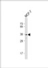 Western Blot at 1:1000 dilution + MCF-7 whole cell lysate Lysates/proteins at 20 ug per lane.