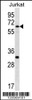 Western blot analysis in Jurkat cell line lysates (35ug/lane) .