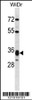 Western blot analysis in WiDr cell line lysates (35ug/lane) .