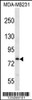 Western blot analysis in MDA-MB231 cell line lysates (35ug/lane) .