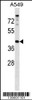 Western blot analysis in A549 cell line lysates (35ug/lane) .