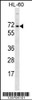 Western blot analysis in HL-60 cell line lysates (35ug/lane) .